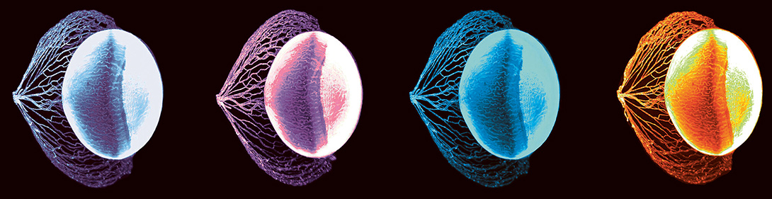 Les avancées de l’étude en 3D de l’œil de souris par transparisation